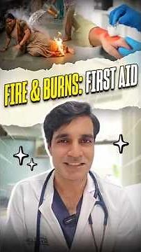 First aid - Fire and Burns! #health #burns #fire #fireathome