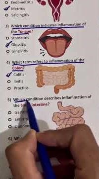 MEDICAL TERMS QUIZ