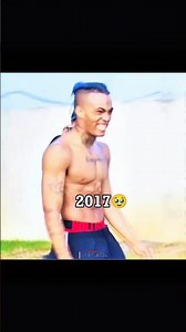 💔 I Miss You 🥺💞 | XXXTENTACION Sad Emotional Edit | Lovely 🎵 | 2017 → 2018 🕊️ #xxxtentacion #shorts