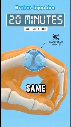 Cracking Knuckles: Why Does It Make That Sound?” #skeleton #facts