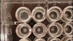 High-Throughput Live Imaging of Microcolonies to Measure Heterogeneity in Growth and Gene Expression