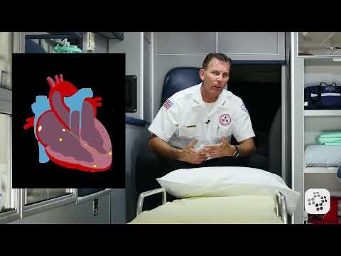 Supraventricular Tachycardia EKG/ECG (PALS Rhythm Strips) | Training Video
