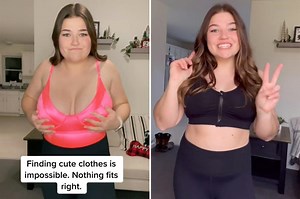 Woman gets life-changing breast reduction