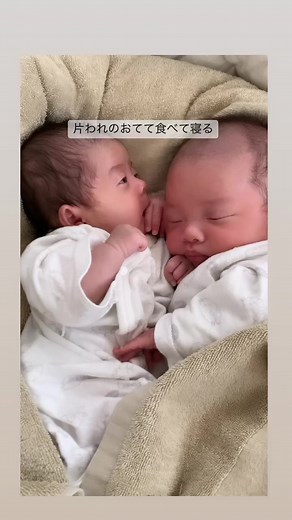 双子の成長記録と寄生双生児の生活