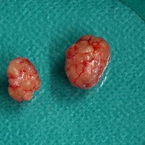 Video: Creation and Maintenance of a Living Biobank - How We Do It