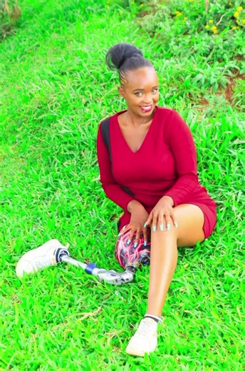 Innovations in Above-Knee Modular Prosthetic Leg