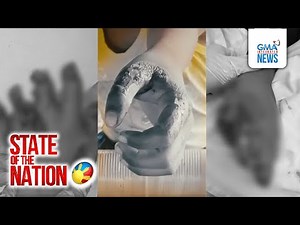 Ilan pang mga batang nasabugan ng paputok at boga, naitala sa Pangasinan at Negros Oriental | SONA