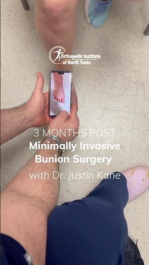 3 Months After Minimally Invasive Bunion Surgery | Dr. Justin Kane, OINT #bunions