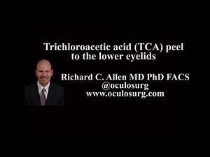 Trichloroacetic acid (TCA) peel