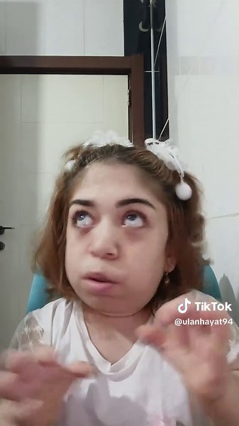 akım yaptım başım döndü 😫