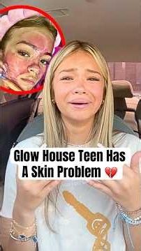 Glow House Teen Has A Skin Problem #shorts #PresLeeFaith #Hyperpigmentation