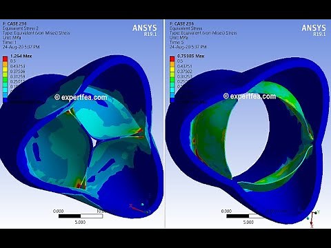 ANSYS WB Static Structural - FEA simulation of the closing and opening of an aortic valve