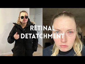 Starting 2023 with Emergency Eye Surgery - Retinal Detachment at 24