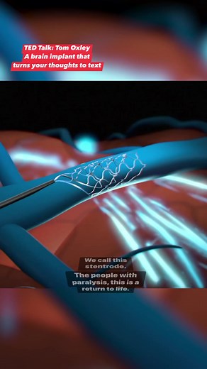 93K views · 896 reactions | With the power of only their mind, this...