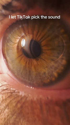 Understanding Central Heterochromia: The Halo Effect in Eyes