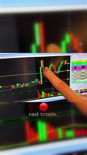 Why this Coinbase trade hit a stop loss.