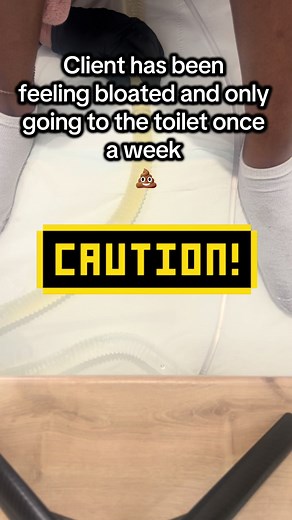 What Is Bloating? Causes and Solutions Explained