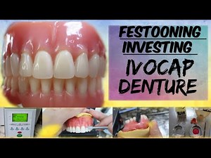 How Complete Upper Denture Processed w/ Ivocap Materials (festooning, investing)