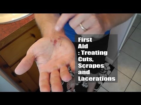 First Aid : Treating Cuts, Scrapes and Lacerations
