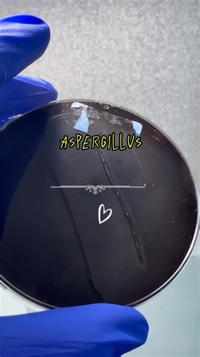 Microbiology on Instagram: "🧫 Aspergillus Género de hongo filamentoso (moho) ➡️ frecuente en microbiología clínica. 🌬️ Distribución: Ubiquitario. Esporas en aire, polvo, materia orgánica. 🔬 Morfología: Hifas septadas, ramificadas a 45°. Conidióforos con vesícula, fiálides y cadenas de conidios 🧵🎯 🧪 Diagnóstico en laboratorio: • Cultivo: colonias algodonosas/blanquecinas que viran a verde, negro o amarillo según la especie. • Tinción: Lactofenol azul de algodón. • Galactomanano y PCR en cas