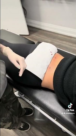 Back Dermal Piercings by Gwen at Xtremities | Mississauga’s Trusted Tattoo & Piercing Studio