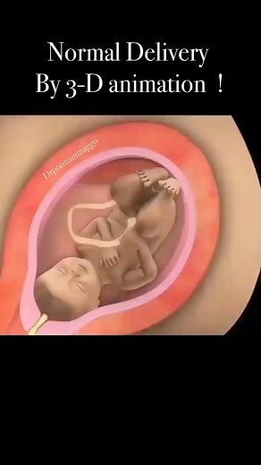 Normal Delivery bu 3-animation #childbirth #pregnancy #birth #doula #pregnant #childbirtheducation #motherhood #baby #postpartum #birthwithoutfear #midwife #newborn #homebirth #birthdoula #naturalbirth #breastfeeding #empoweredbirth #hypnobirthing #laboranddelivery #midwifery #trending#prenatal #birthsupport #labor #maternity #momlife #instagram #instagood #waterbirth #drpoonammaggo | Dr Poonam Maggo