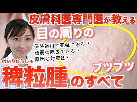 【実は簡単！】皮膚科専門医が教える目の周りのブツブツ「稗粒腫」の治し方と予防法