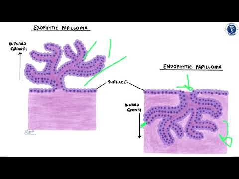 طب المستنصرية | المرحلة الثالثة | PATHOLOGY | RESPIRATORY SYSTEM LEC 1