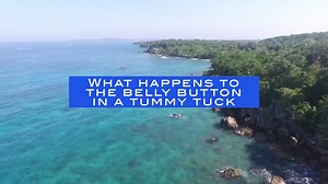 Tummy Tuck: What Happens to the Belly Button?