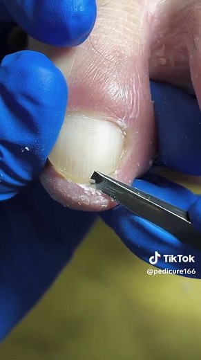 Professional Pedicure Tools for Effective Foot Care