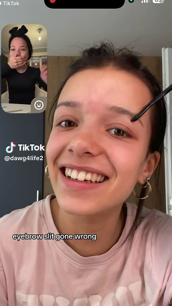 #xcyzbca | eyebrow ends cut off