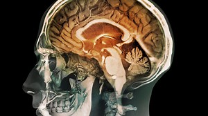 Discovery - Better Brains - BBC Sounds