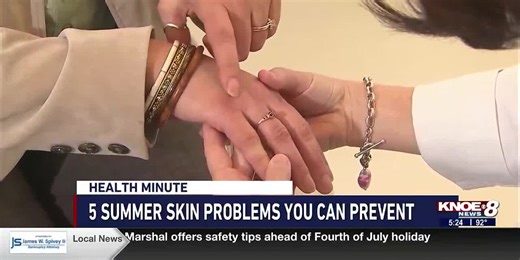 5 Summer skin problems you can prevent