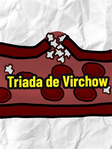 Triada de Virchow: Conceptos Clave para Estudiantes de Medicina