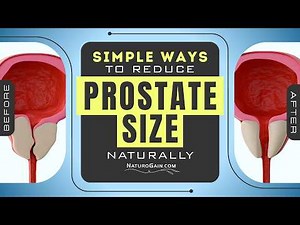 How to Reduce Prostate Size Naturally: Simple, Effective Remedies