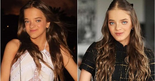 Mudou muito! Veja fotos de antes e depois da cirurgia de Rafaella Justus