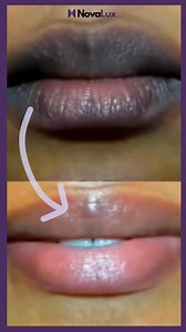 💥Dites adieu aux lèvres foncées et abîmées ! Avec Yoxier™, retrouvez des lèvres douces et rosées en à peine 2 semaines 💋 ✨ Formule 2 en 1 : Exfolie Hydrate Répare 🌿 100% Naturelle – sans produits chimiques ⚡ Résultats visibles dès 7 jours 💬 “En 10 jours, mes lèvres ont retrouvé leur couleur d’avant !” – Karim ⭐⭐⭐⭐⭐ 👉 Commandez dès maintenant et redonnez vie à vos lèvres naturellement ! https://buydexshop.myshopify.com/products/yoxier™-serum-eclaircissant-pour-levres-foncee-ou-ternies-par-le