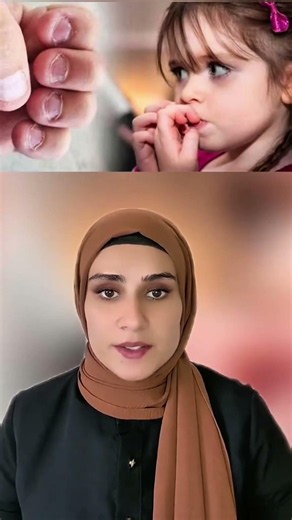 If you bite your nails, you must watch this #explore #shorts