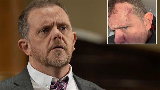 Emmerdale's Liam Fox reveals cancer battle after eight year fight for treatment