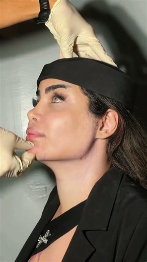 Watch: Discover a professional facial contouring and aesthetic treatment designed to enhance facial