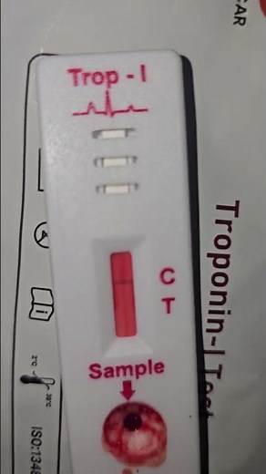How to do Cardiac Troponin I Test #imwell #spotdiagnosis #medical #cardiovasculartest #Heartattack