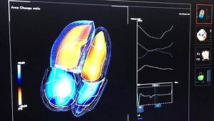 43K views · 363 reactions | This is an example of Canon Medical...