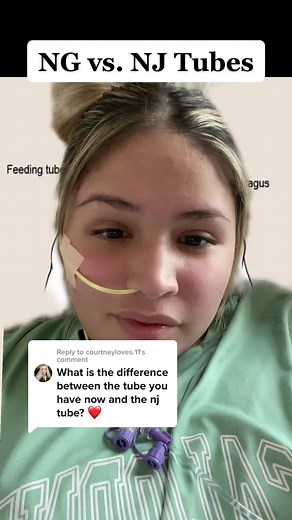 Understanding the Difference Between NJ and NG Tubes