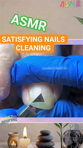 ASMR Nails Cleaning #satisfying #Relaxing #Nails. Clipped, pedicure, podiatry. #vlogmas #shorts