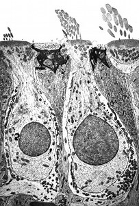 The curious case of wobblers