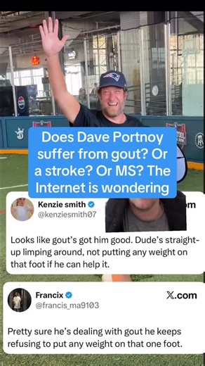 After watching Dave’s performance in the “Poop Race” (a foot race against a D1 football player who Dave said looked like he runs with poop in his pants) (a race which Dave won, fair and square, btw) the internet grew concerened that maybe El Presidente suffers from the King’s disease, Gout. Others thought it was the results of a stroke, or multiple sclerosis ravaging his body. Dave will say it’s because he pulled his hamstring while warming up for the race, but he’s not an excuses guy | Kevin Cl