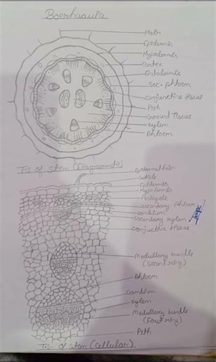 ##Boerhavia#Abnormal character Anatomy with figures#BSC 3 semester#Botany practical file##