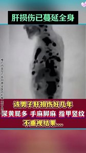 [年龄][男人女人]熬夜爆肝闭眼入！有它我又能“肝”了！加急发货！