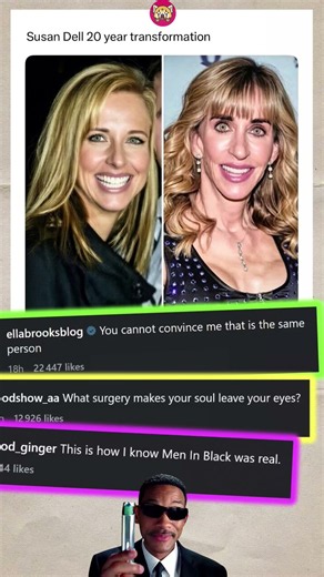 What Happened To Susan Dell's Face?