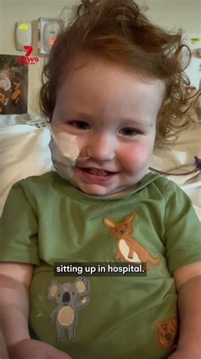 New photos show toddler recovering after freak baking accident